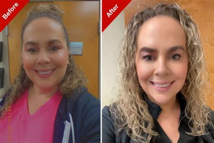 Celebrities Before and After Ozempic: Transformations, Health, and Beyond
