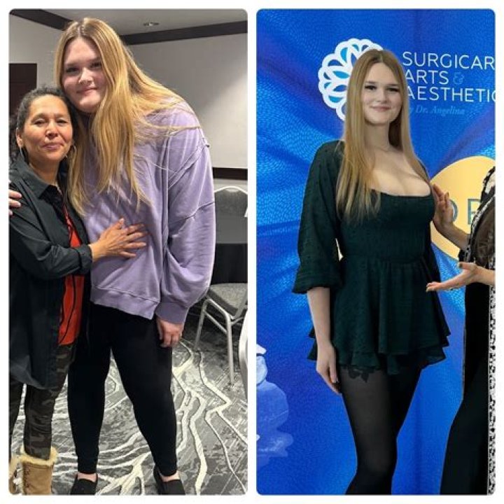 Celebrity Ozempic Before and After: The Surprising Weight Loss Transformation