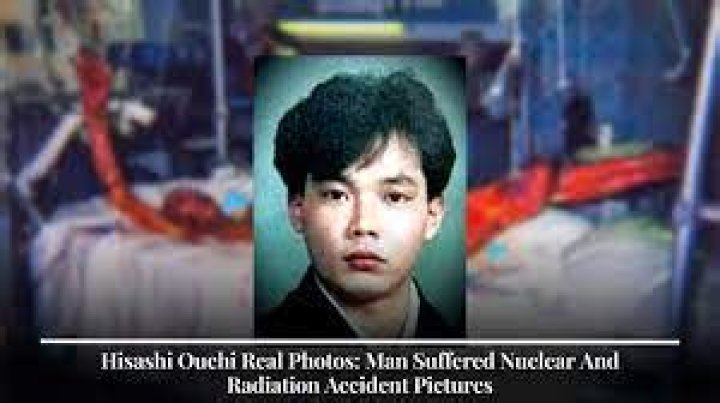 Hisashi Ouchi Pictures: Unveiling the Truth Behind the Real Images