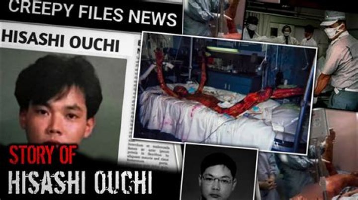 Hisashi Ouchi Real Body Photos: The Shocking Truth Behind the Tragic Incident